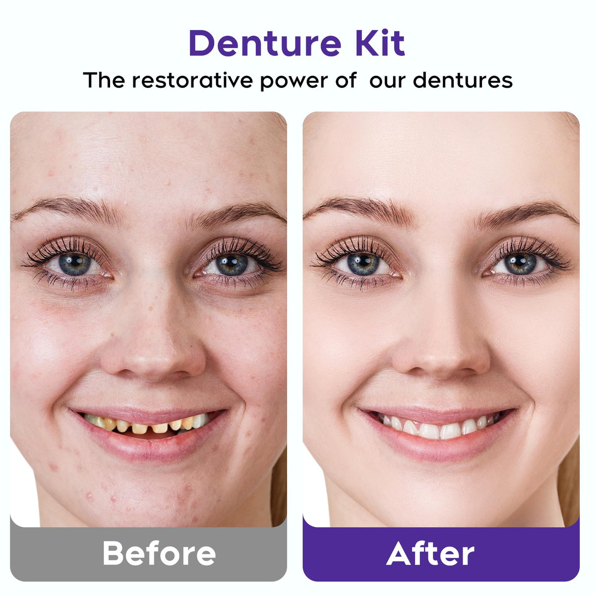 DIY Denture Kit for Upper & Lower Teeth U309951